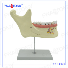 PNT-0537 Modelo de dentes dentais de maxilar inferior alargado